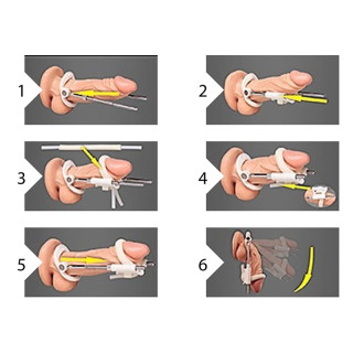 Extenseur de pénis noir Pumped mode d'emploi